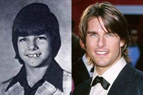 Ünlülerin çocukluk halleri 13