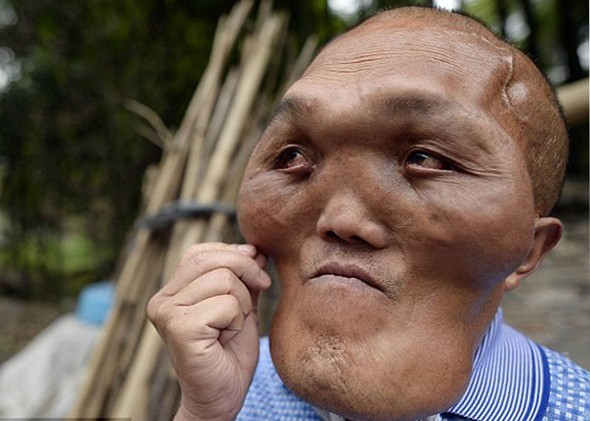 Doku büyümesi hayatını kararttı 1