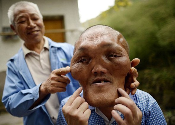 Doku büyümesi hayatını kararttı 2