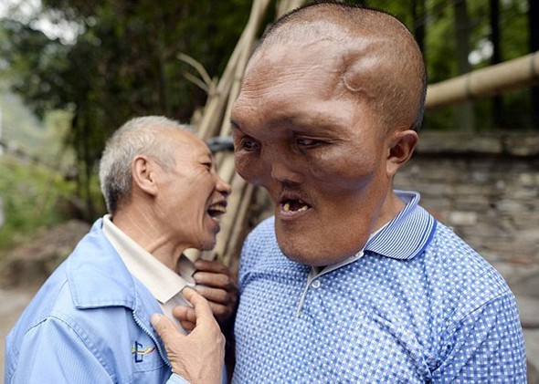 Doku büyümesi hayatını kararttı 3