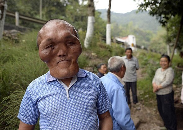 Doku büyümesi hayatını kararttı 4