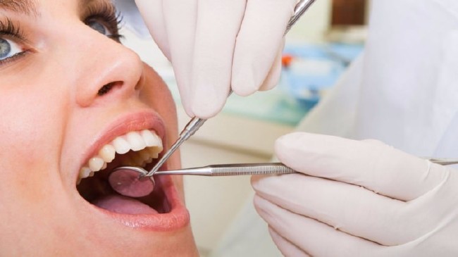 Uzmanlar uyarıyor ağızdaki dolgu sayısına dikkat 22