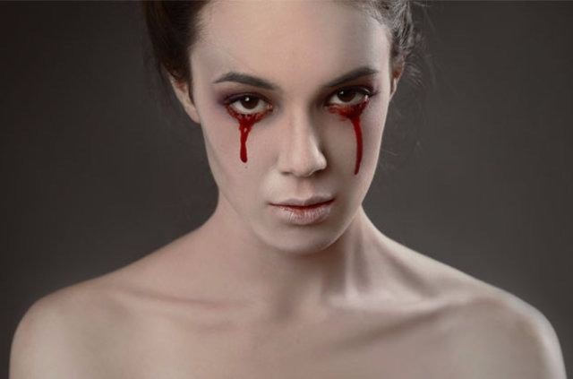 Kan ağlamak gerçekten mümkün mü? 1