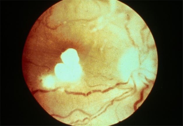 Bir bardak suyla sağlık testi 19