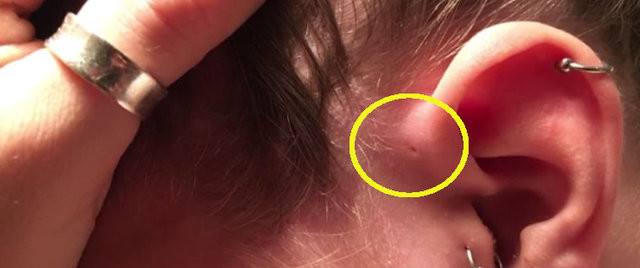 İnsan kulağının üzerinde yer alan delik nedir? 7