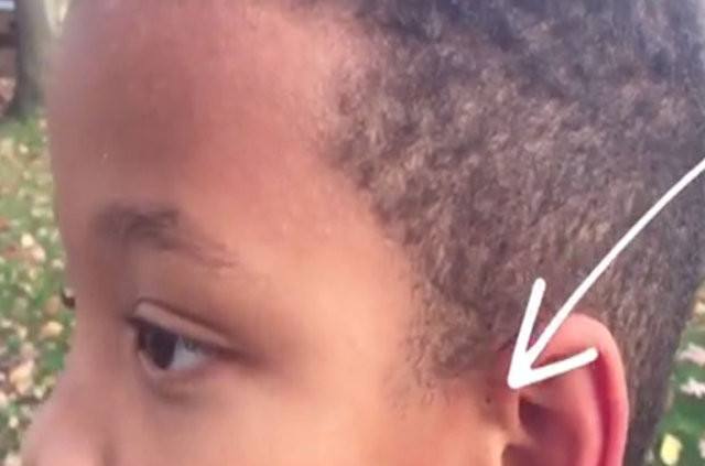 İnsan kulağının üzerinde yer alan delik nedir? 3