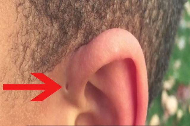İnsan kulağının üzerinde yer alan delik nedir? 1
