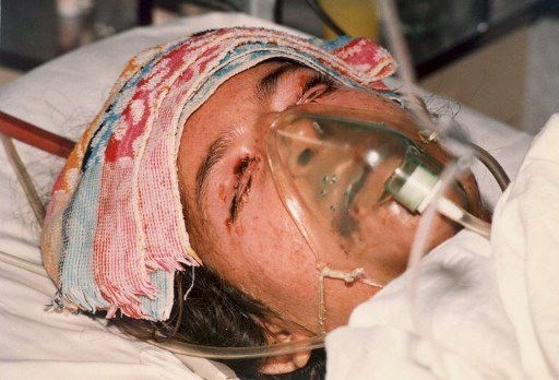 30 yıldır kanayan yara: Halepçe Katliamı 11