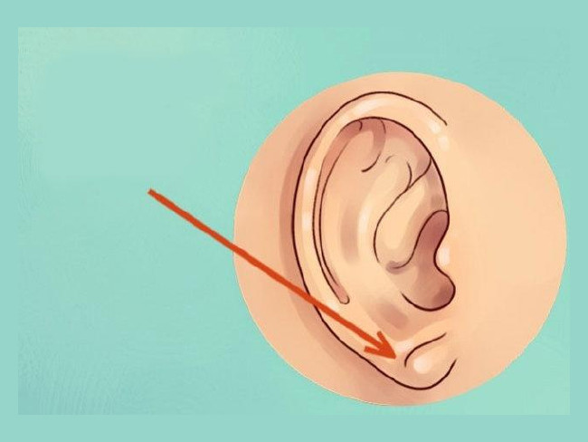 Kulaktaki hangi bölge hangi ağrıyı kesiyor? 7