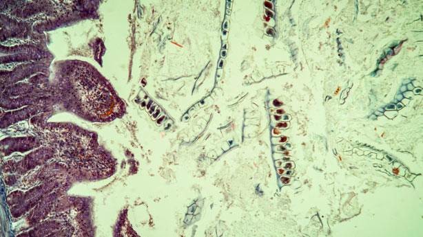 10 hastalık 10 tuhaf komplo 6