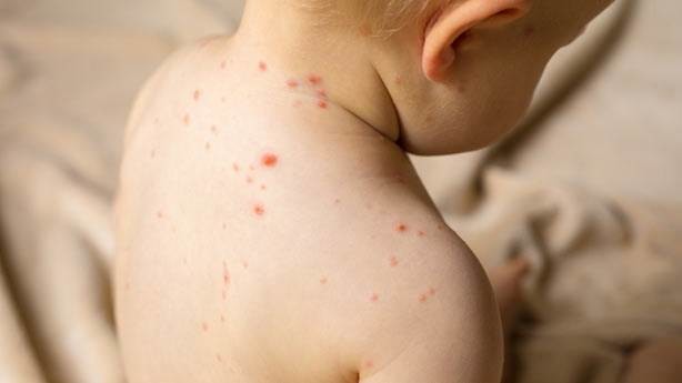 10 hastalık 10 tuhaf komplo 10