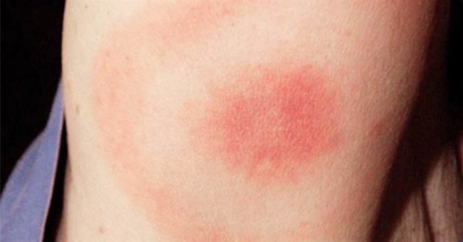 10 hastalık 10 tuhaf komplo 15