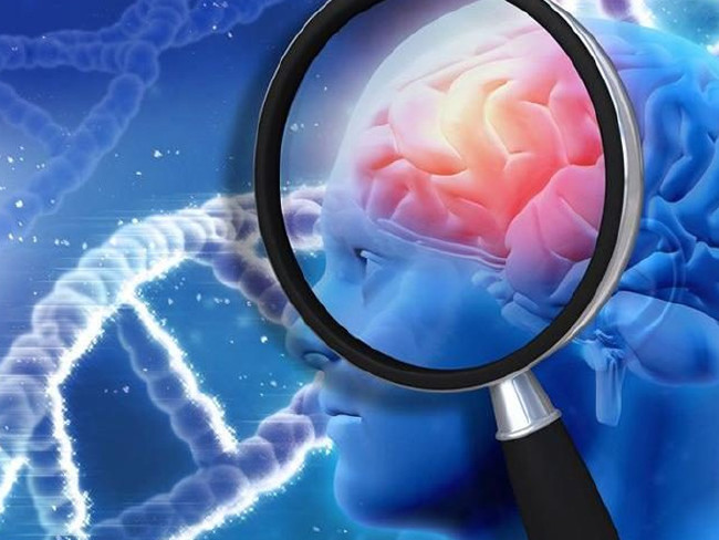 Beyni genç tutmak için soğan tüketin 1