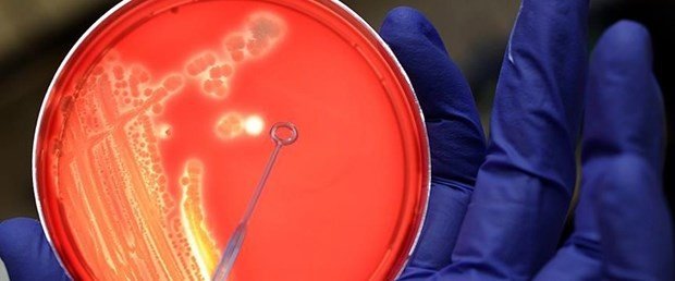Nedeni pek bilinmiyor ama vücuttaki her organı etkileyebiliyor 12