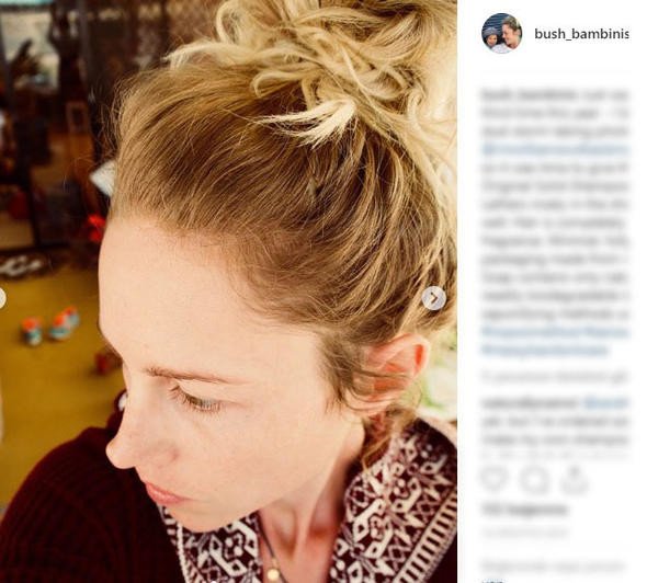 Tam 1 yıldır şampuan kullanmıyor 10