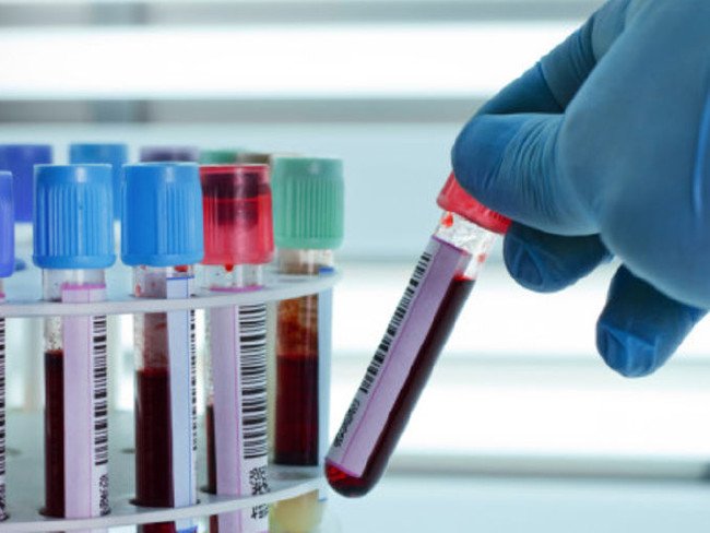 Ünlülerin hastalıkları 1