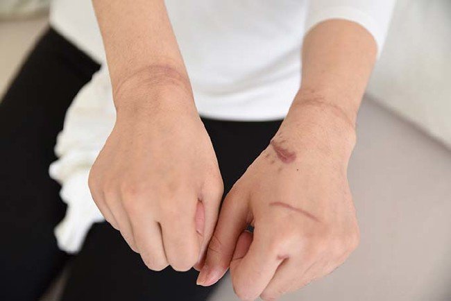 Emre Çiçek, Rabia K'ya vahşeti yaşattı 5