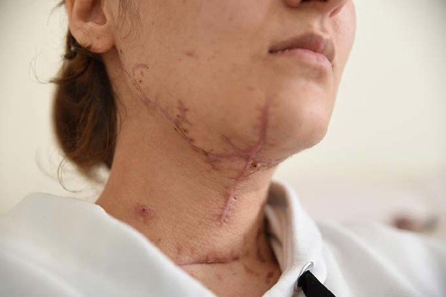 Emre Çiçek, Rabia K'ya vahşeti yaşattı 8