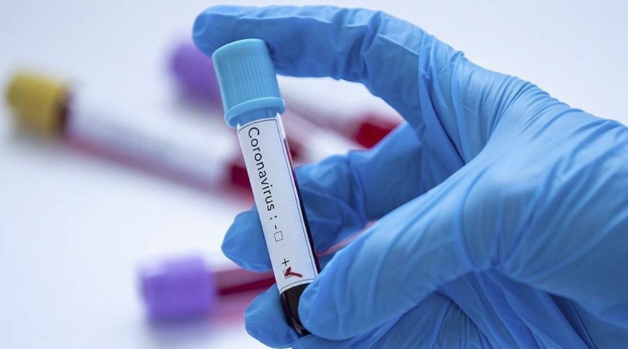 Koronavirüsün organ organ etkileri! Koronavirüs vücudumuza ne yapıyor 6