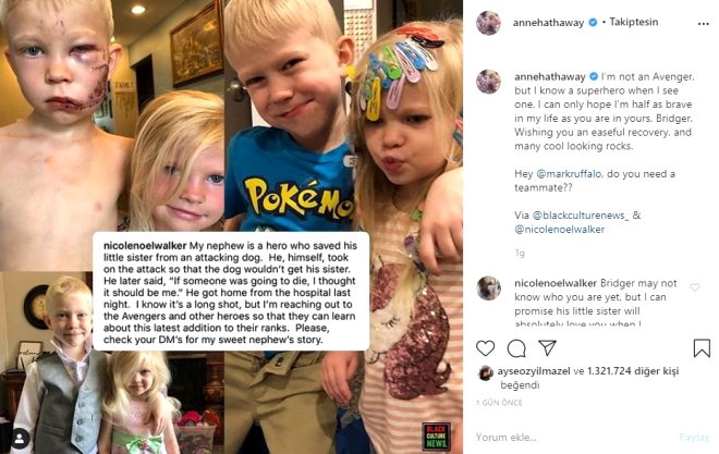 Dünya, kız kardeşini köpek saldırısından kurtaran minik kahramanı konuşuyor 6