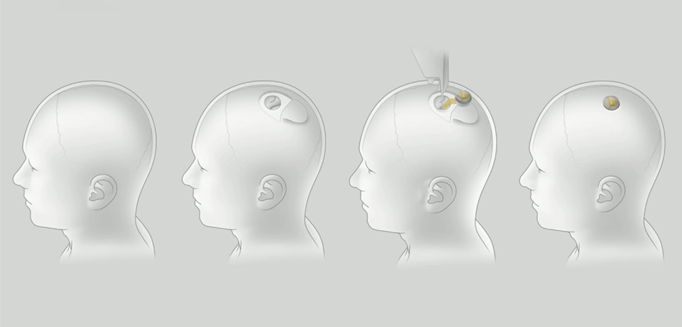 Yakın gelecekte insan hayatına ortak olacak nöroteknoloji şirketleri 14