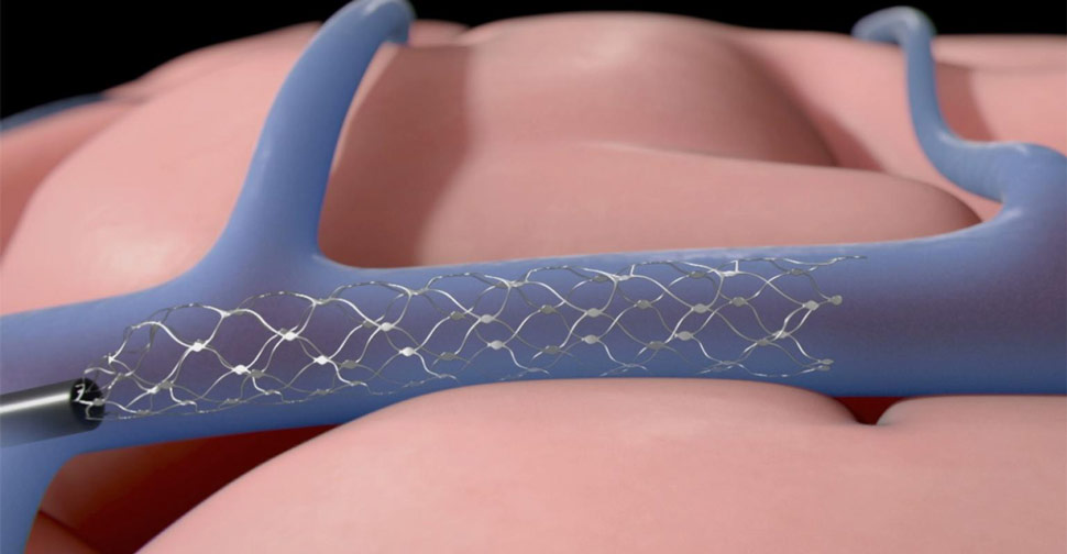 Yakın gelecekte insan hayatına ortak olacak nöroteknoloji şirketleri 12