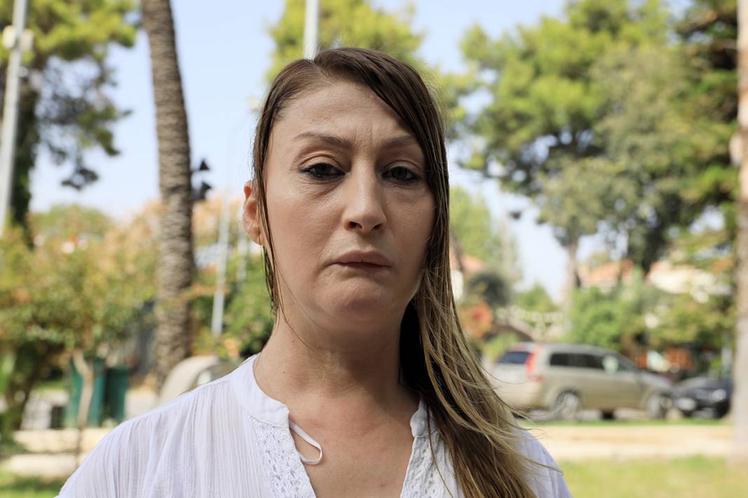 Estetik mağduru kadın: Gülmeyi unuttum, mimiklerimi kaybettim 1