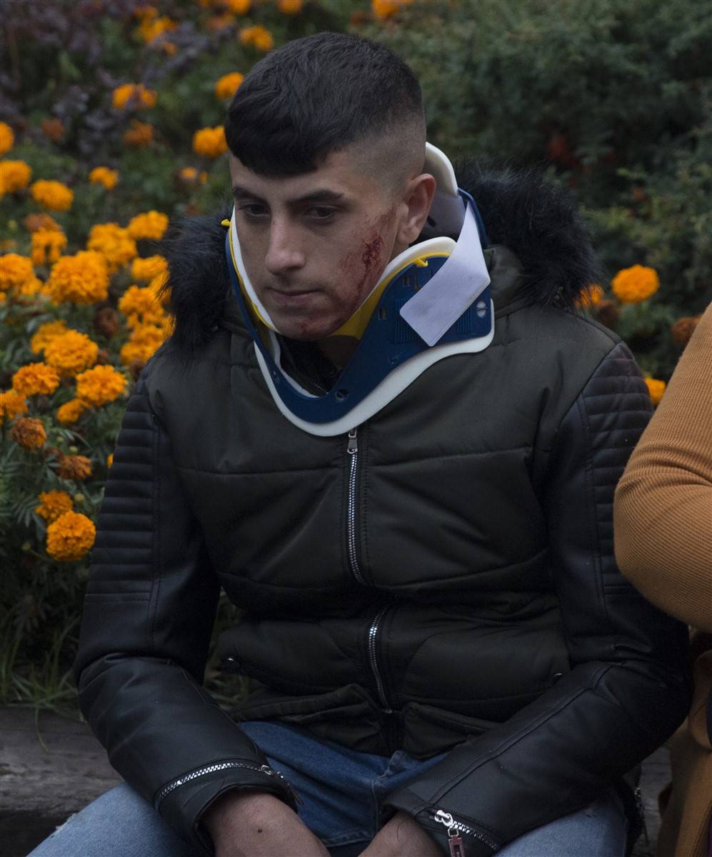 Ankara'da can pazarı! İki otobüs çarpıştı 8