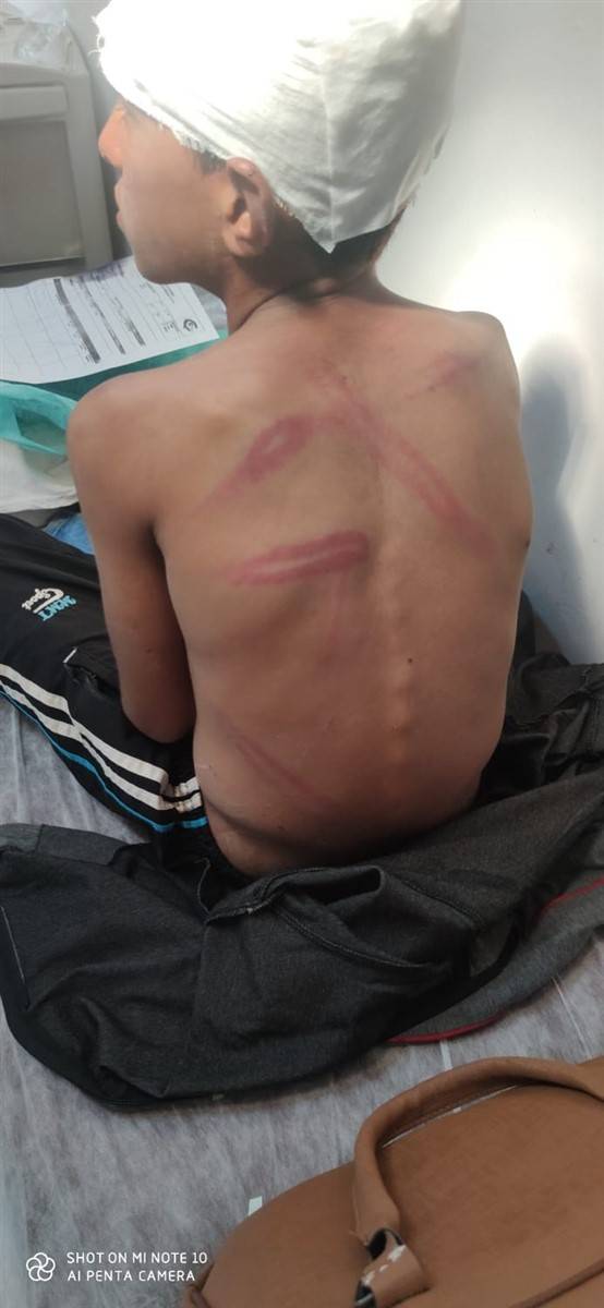 10 yaşındaki çocuğu ölümüne dövdüler! 3