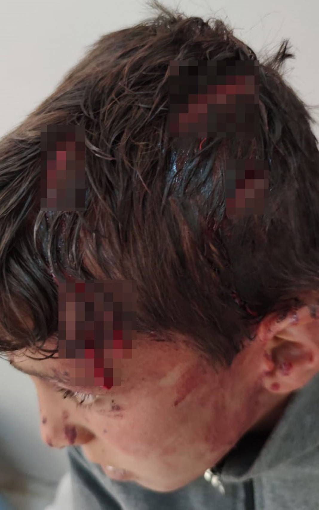 10 yaşındaki çocuğu ölümüne dövdüler! 4