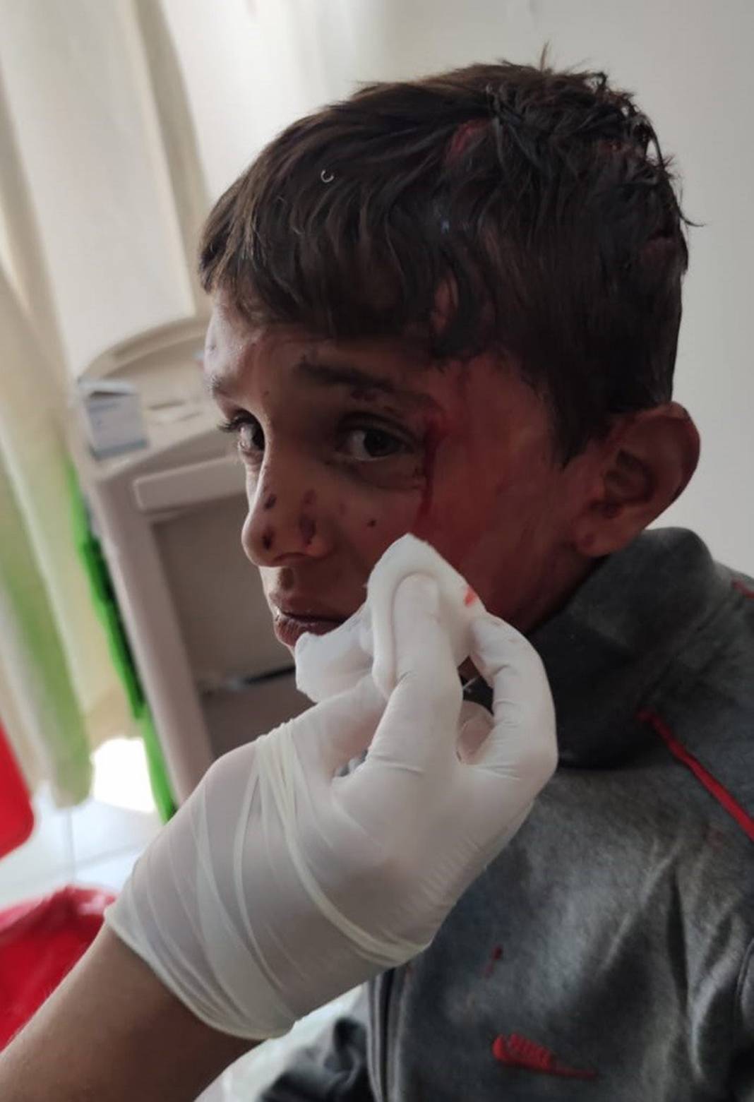 10 yaşındaki çocuğu ölümüne dövdüler! 5