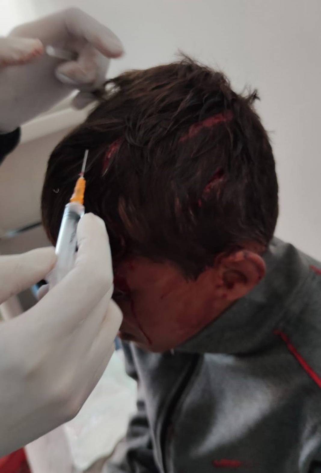 10 yaşındaki çocuğu ölümüne dövdüler! 6