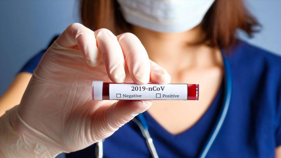 Koronavirüs salgınına ne iyi geliyor? 3