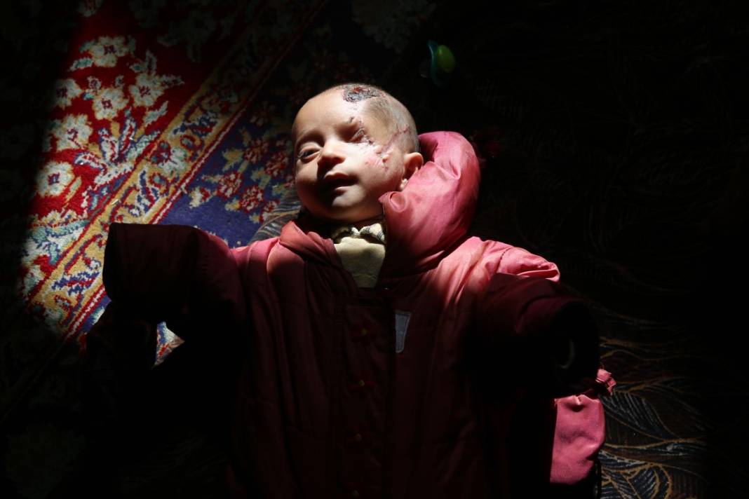 Ortadoğu'yu kavuran iç savaş! 10 yıl geçti, geride kan ve gözyaşı kaldı 8