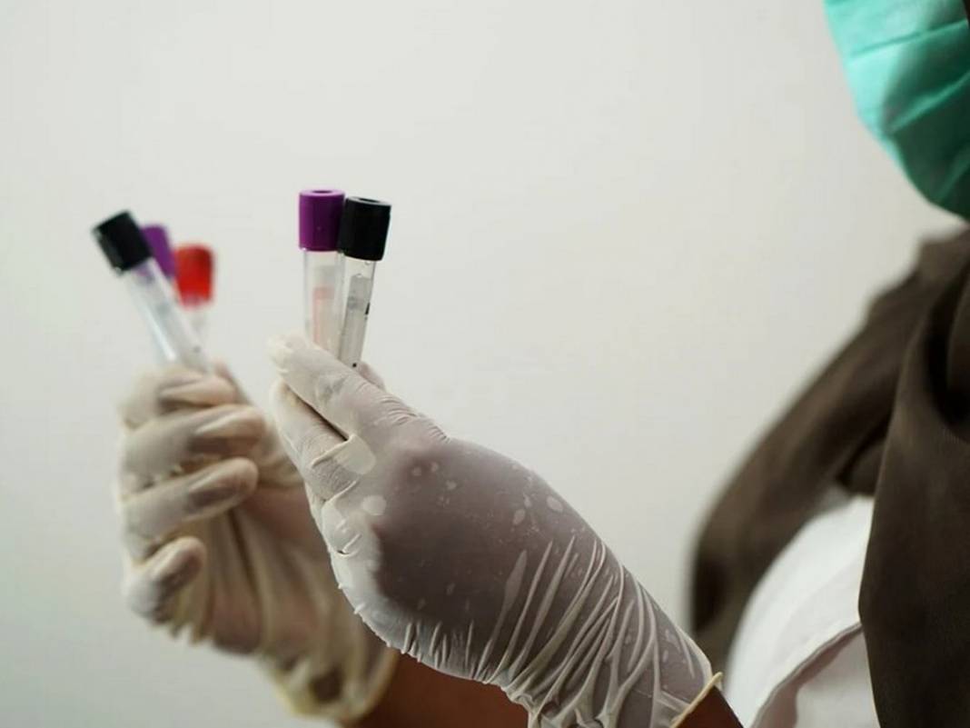 100 bin Kovid-19 hastası incelendi! Kan grubu etkiliyor mu? 4