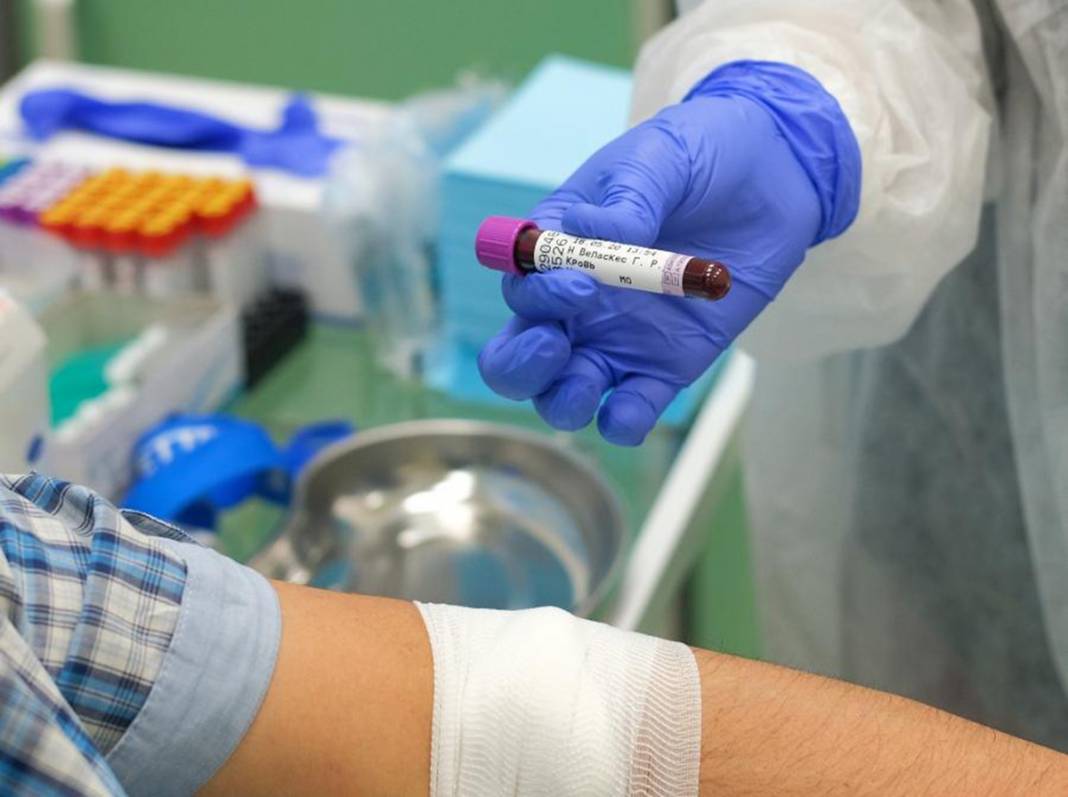 100 bin Kovid-19 hastası incelendi! Kan grubu etkiliyor mu? 6