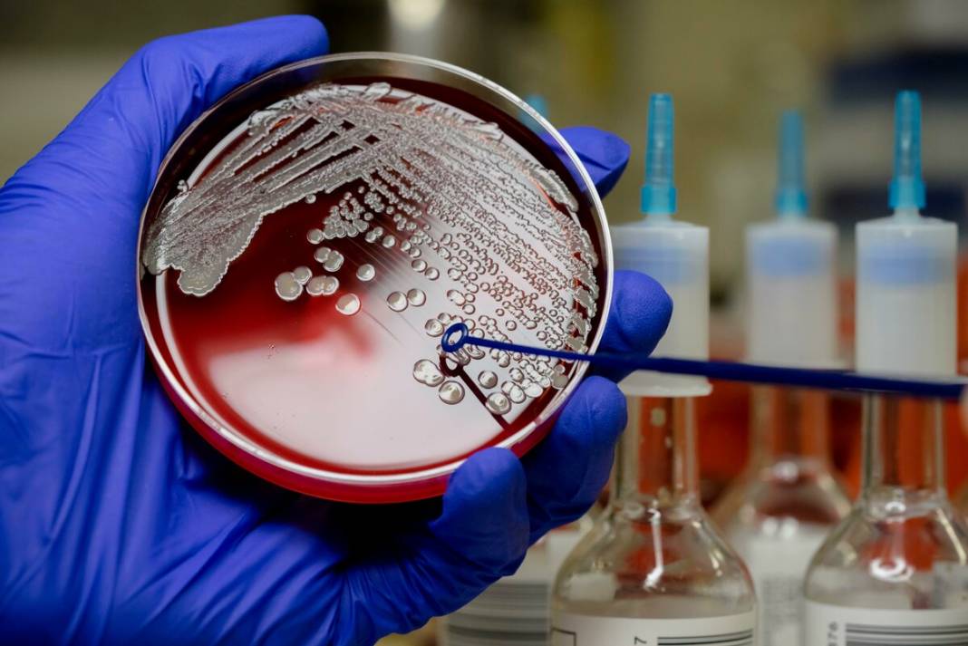 Sibirya'da donmuş toprakta bulundu! Mikroskobik Drakula 24 bin yıldır yaşıyor 6