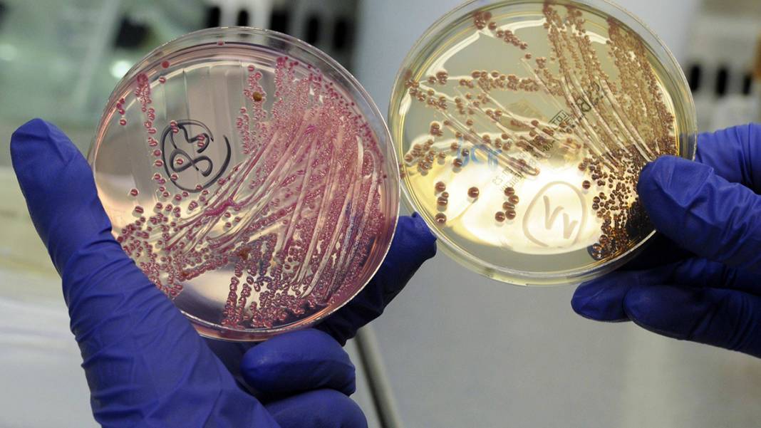 Sibirya'da donmuş toprakta bulundu! Mikroskobik Drakula 24 bin yıldır yaşıyor 7