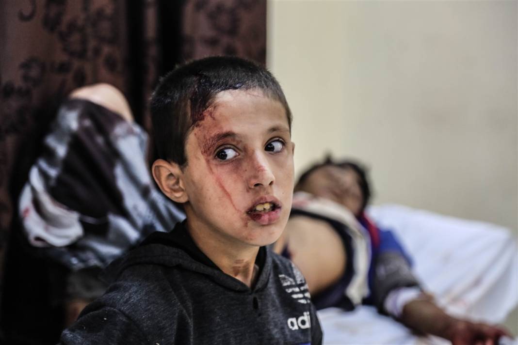 Misket bombalarıyla gelen vahşet! Esad çadır kampı vurdu 20