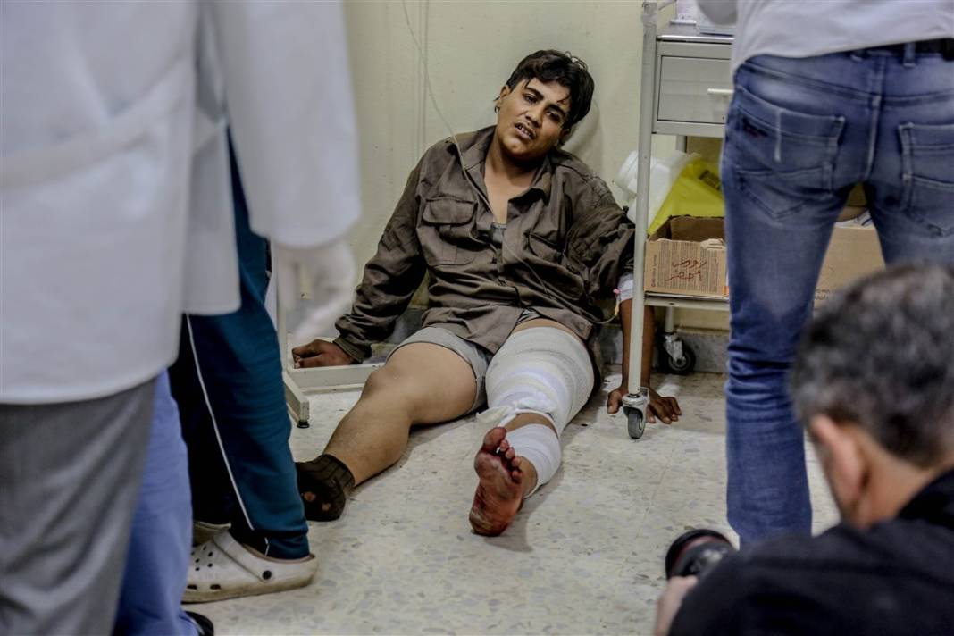 Misket bombalarıyla gelen vahşet! Esad çadır kampı vurdu 16