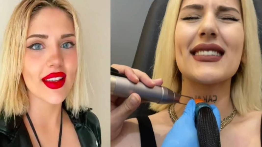 Kısmetse Olur Aybüke neydi ne oldu! Son halini gören evine posterini asacak... Estetiğin gücü bir kez daha kanıtlandı 4