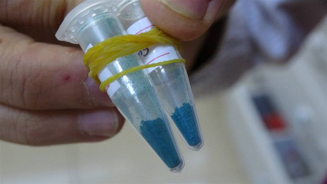 Türk bilim insanlarından çığır açacak buluş! Kötü huylu kanser hücresini yok ettiler 12