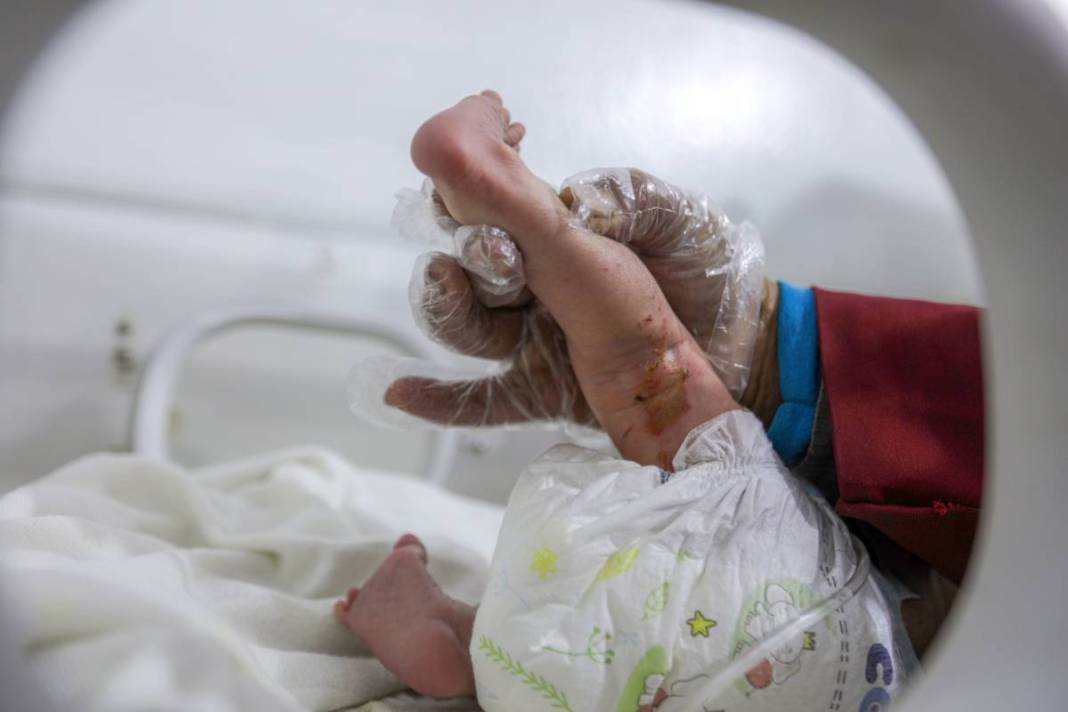 Deprem onu yetim ve öksüz bıraktı: Eye bebek için binlerce kişi sıraya girdi 5