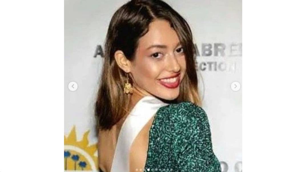 Güzelliği Allah vergisi değilmiş! Dilan'ın estetiksiz halini gören küçük dilini yuttu! 6