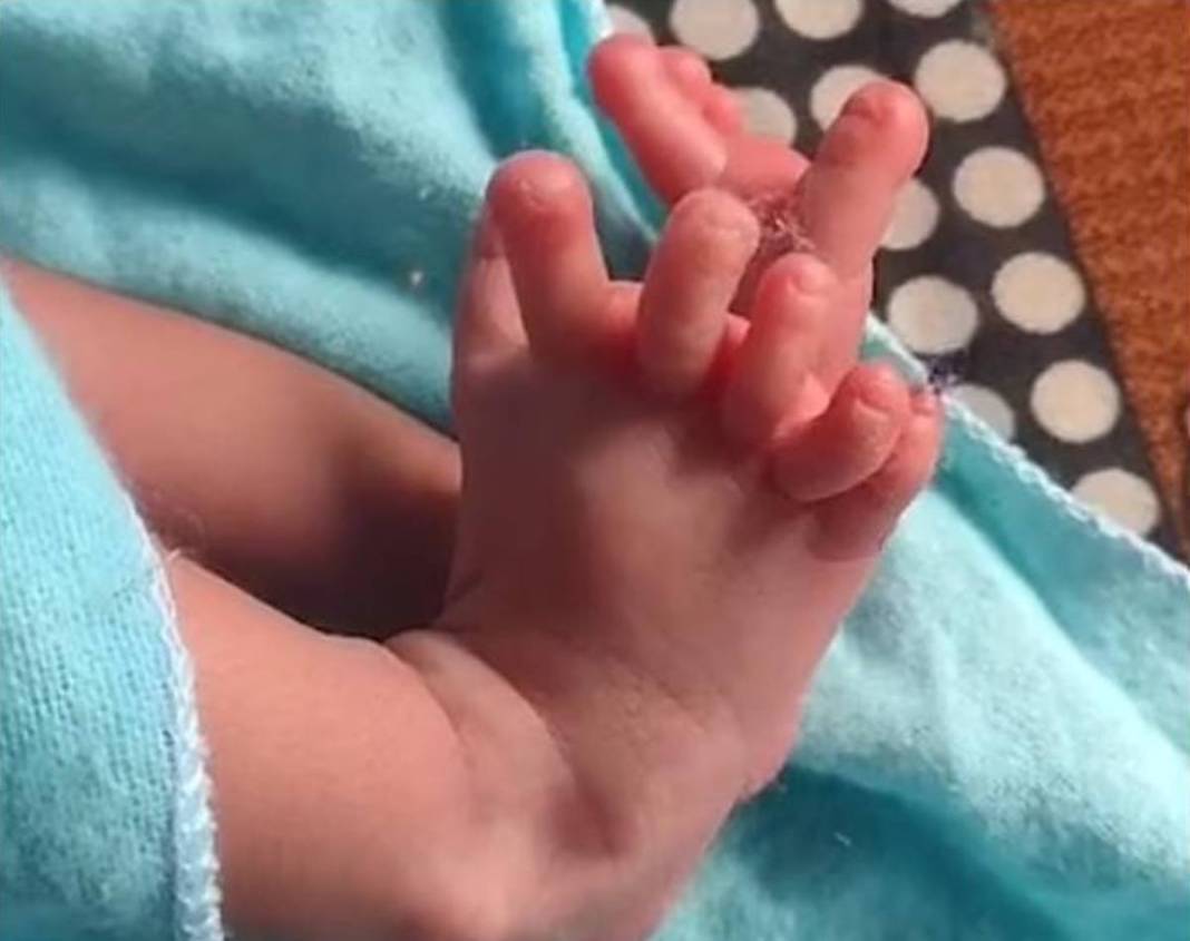 Ребенок родился без пальцев. Ребенок родился без пальцев на руке. Ребенок между маминых ног. Сколько пальцев рожают