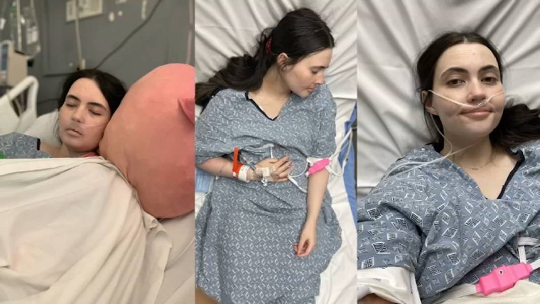 Bildiğiniz tüm hastalıkları unutun! Genç kadının suya alerjisi çıktı, ona terlemek ve ağlamak bile yasak 7