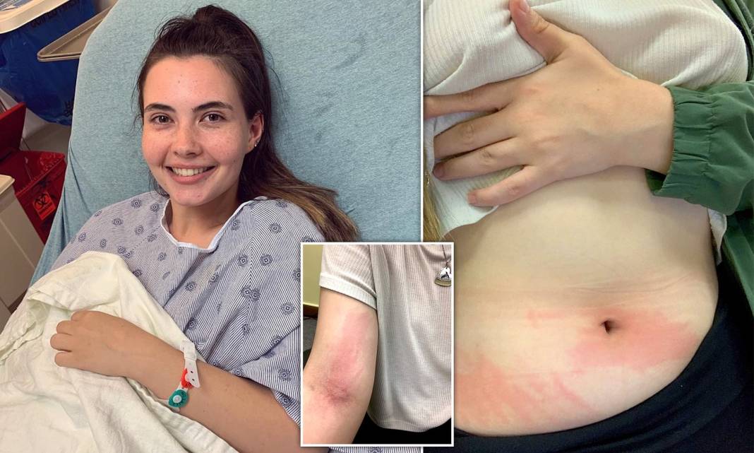 Bildiğiniz tüm hastalıkları unutun! Genç kadının suya alerjisi çıktı, ona terlemek ve ağlamak bile yasak 8