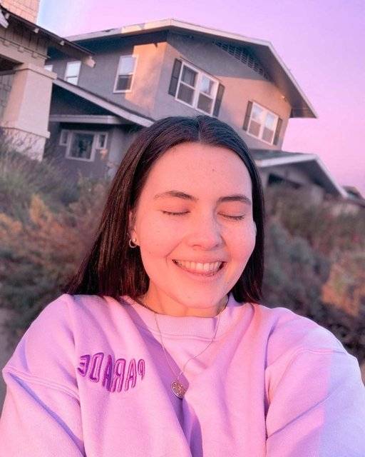 Bildiğiniz tüm hastalıkları unutun! Genç kadının suya alerjisi çıktı, ona terlemek ve ağlamak bile yasak 2