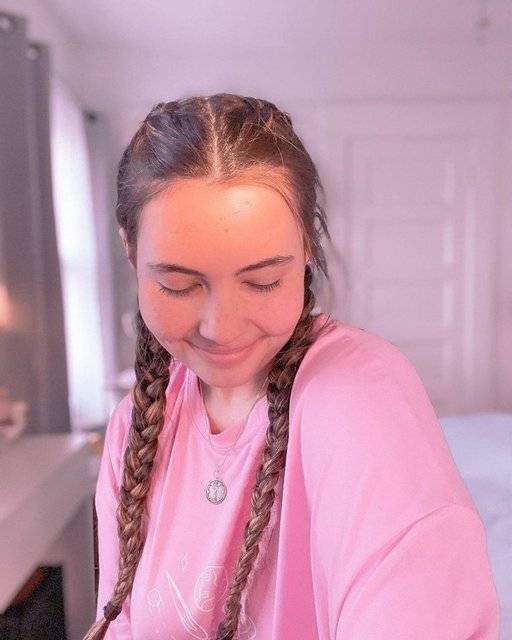 Bildiğiniz tüm hastalıkları unutun! Genç kadının suya alerjisi çıktı, ona terlemek ve ağlamak bile yasak 5