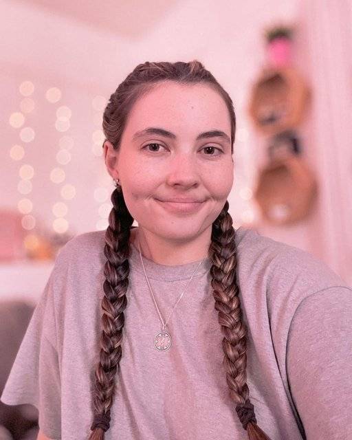 Bildiğiniz tüm hastalıkları unutun! Genç kadının suya alerjisi çıktı, ona terlemek ve ağlamak bile yasak 3